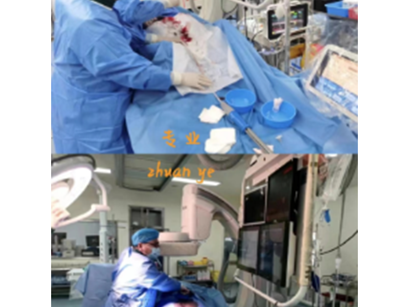 下腔靜脈傘形濾器置入術