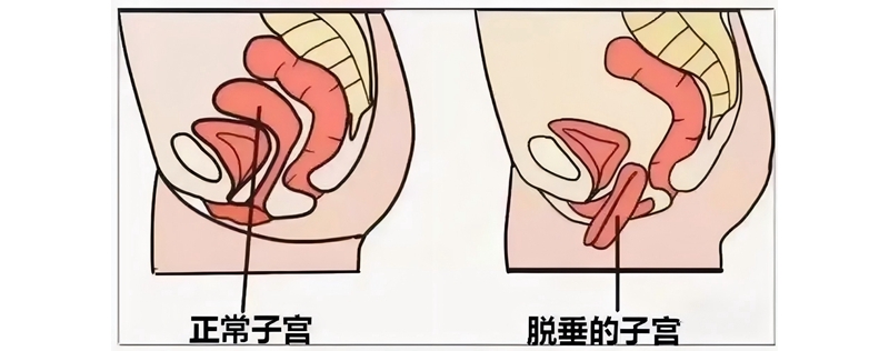 銅川礦務局中心醫院婦科成功開展首例腹腔鏡下子宮骶前筋膜懸吊手術 ...